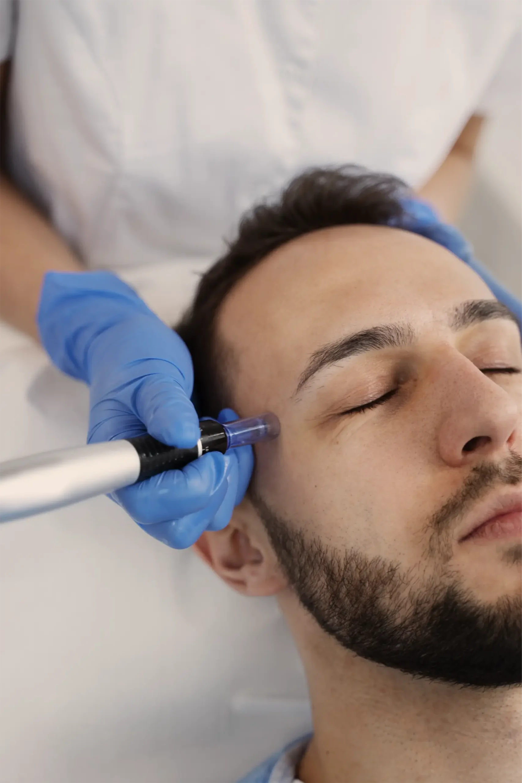 Athéna Laser microneedling