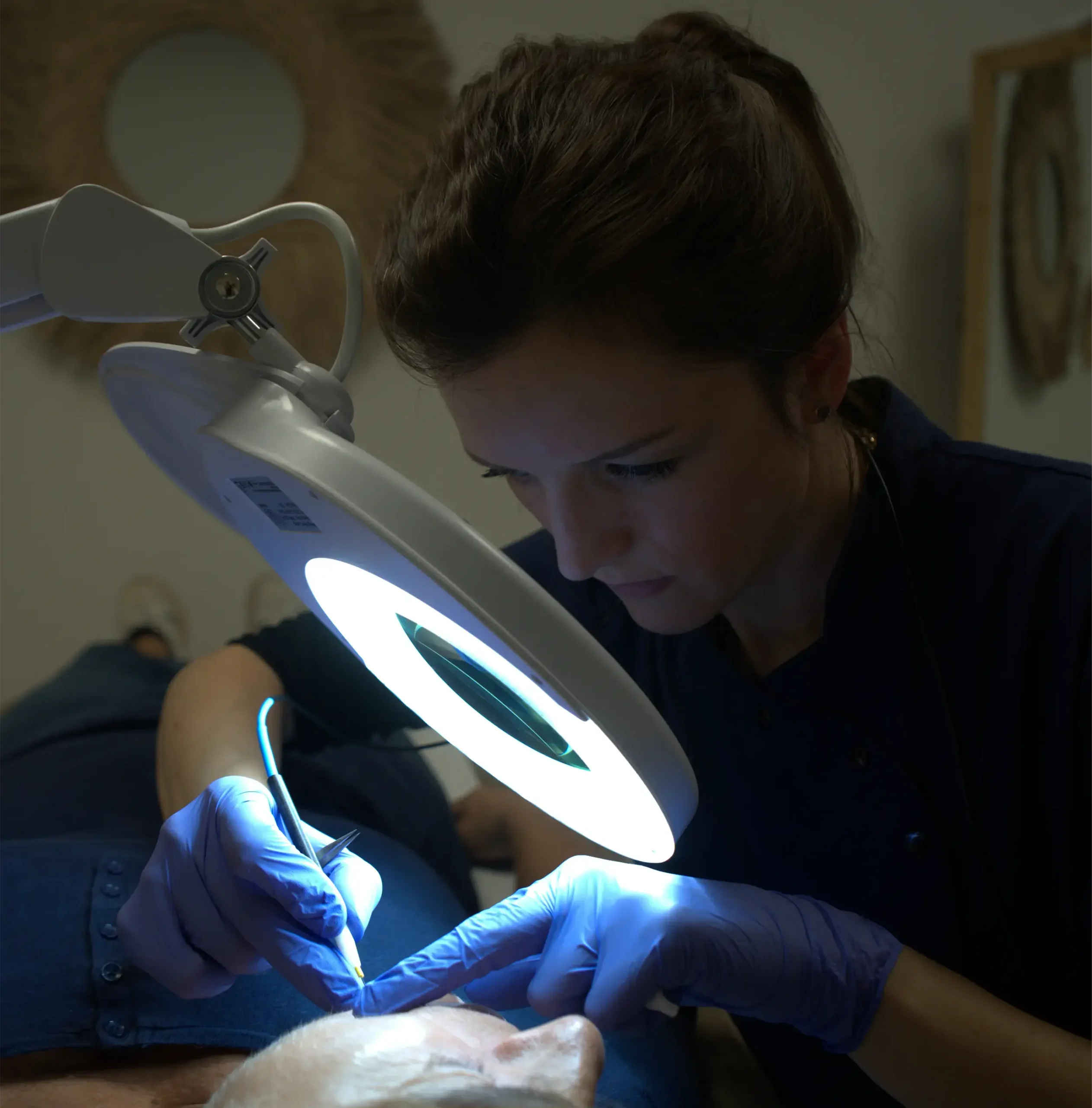 Athena Laser epilation éléctrolyse