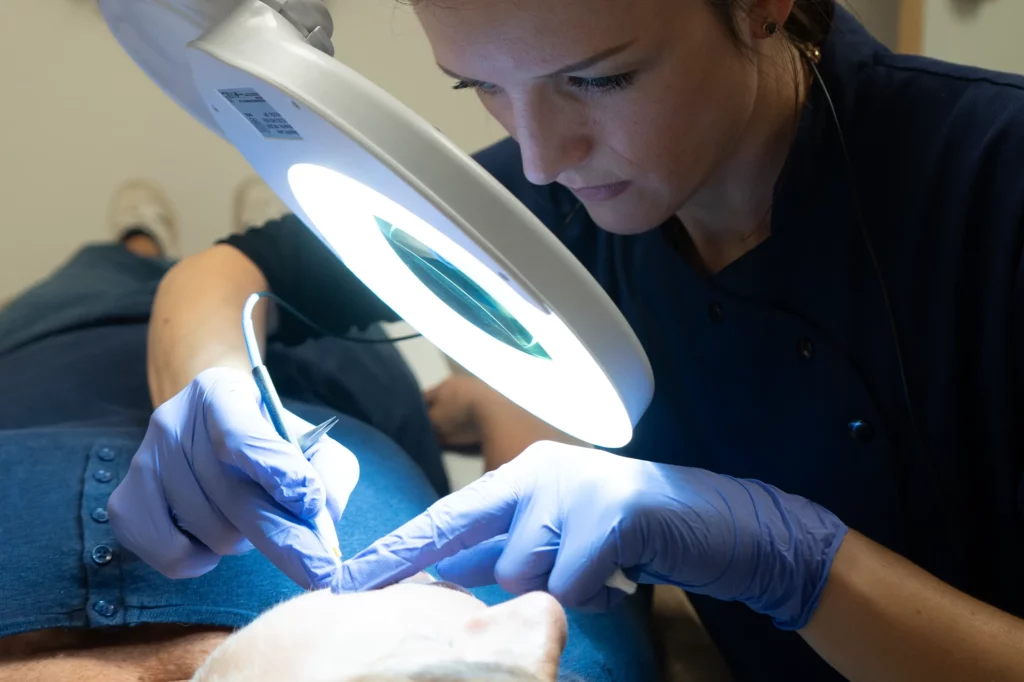 Athena Laser epilation par electrolyse