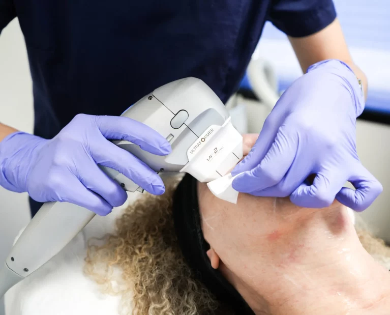 Athena Laser HIFU