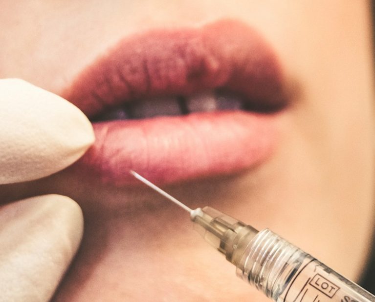 injection-acide-hyaluronique-botox